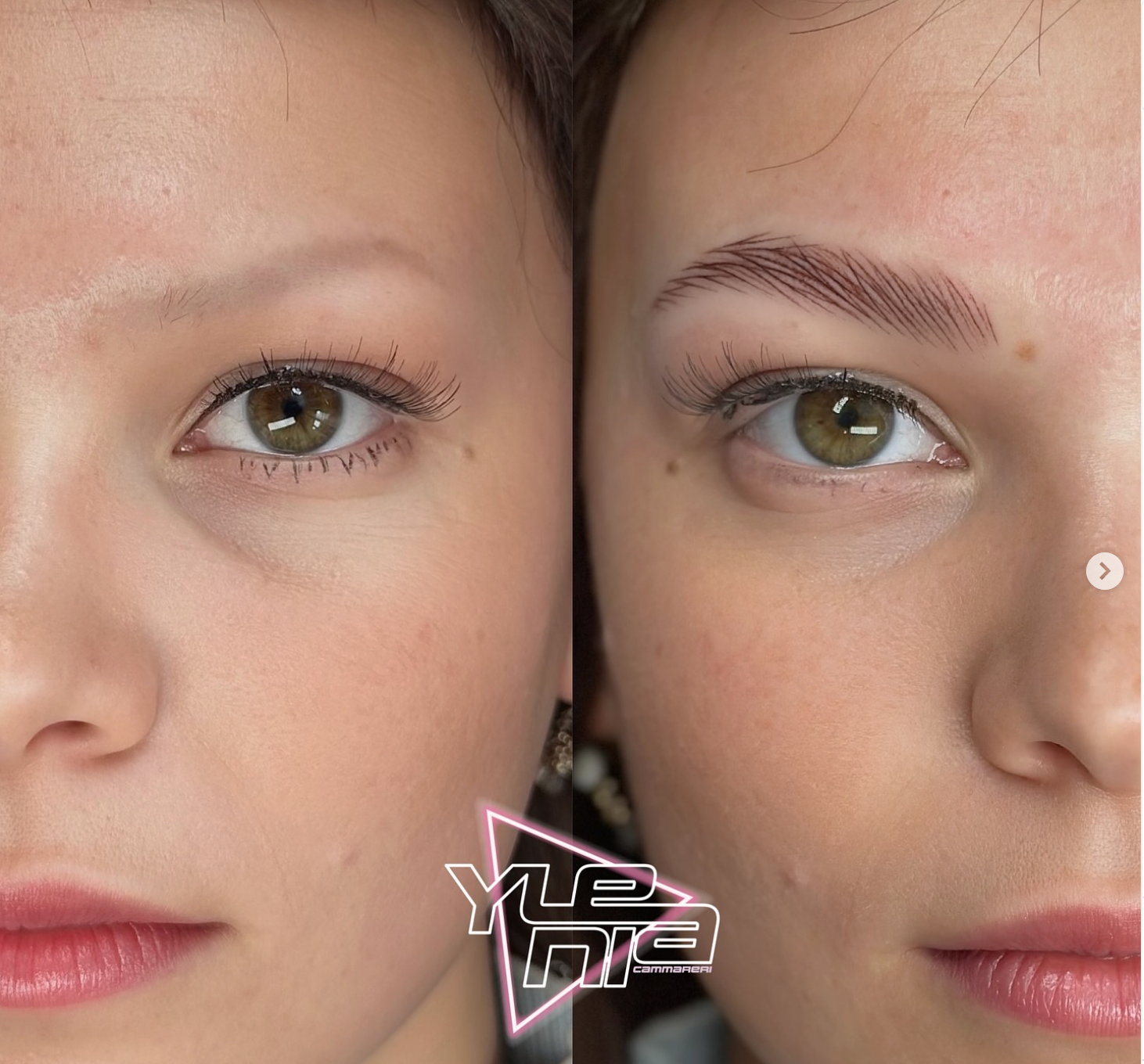 Ricostruzione dell'arcata sopraccigliare con la dermopigmentazione