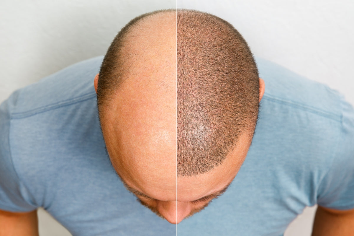 TRICOPIGMENTAZIONE: SCIENZA, PIGMENTI E UN EFFETTO RASATO CHE BATTE MADRE NATURA